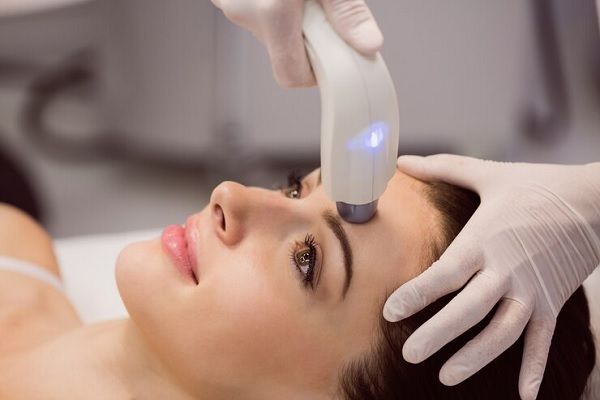 Radiofrecuencia facial