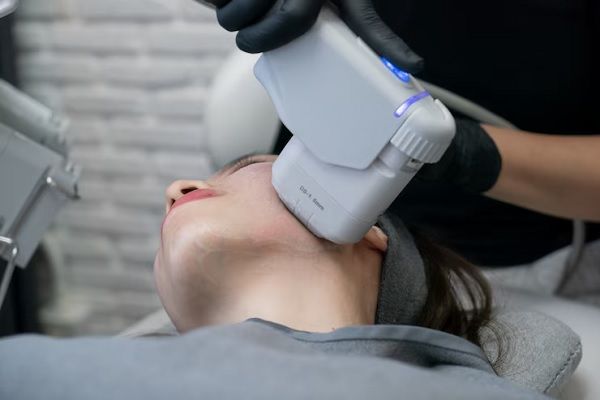 Radiofrecuencia facial