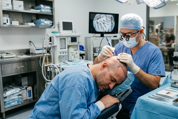 Injerto capilar Madrid precio - Médico tricólogo realizando un injerto capilar Madrid a un hombre con alopecia en la coronilla