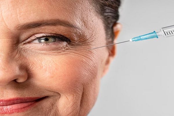 mujer de avanzada edad se aplica botox en patas de gallo