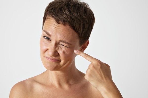 Tipos de arrugas - Mujer señalando con su dedo la arruga que tiene en el párpado