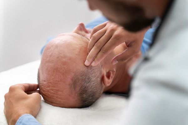 Trasplante capilar Precio - Paciente preparándose para injerto capilar Barcelona