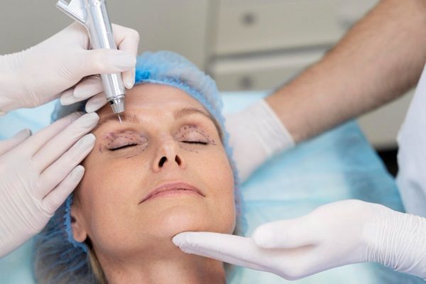 Blefaroplastia - Cirujanos realizando un tratamiento de blefaroplastia laser a una mujer para rejuvenecer el rostro
