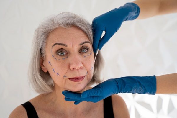 Médico realizando un tratamiento de hilos tensores en Madrid a una mujer para rejuvenecer el rostro y corregir las arrugas