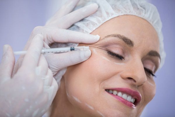Bótox o ácido hialurónico - Médico estético aplicando una inyección de ácido hialurónico Madrid en el rostro de una mujer para eliminar las arrugas dinámicas