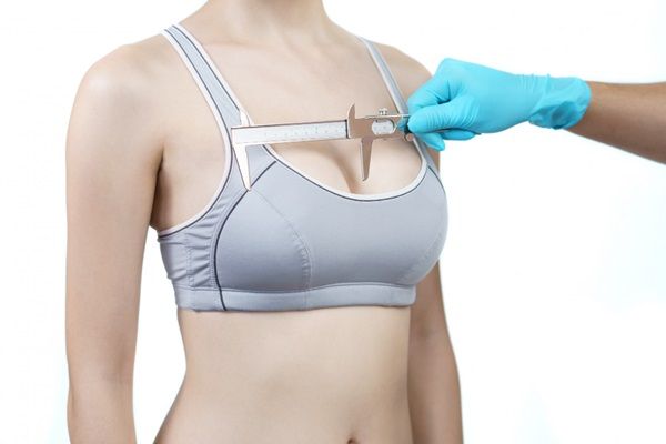 Mastopexia sin implantes - Doctor midiendo la simetría de los pechos de una mujer para realizar una mastopexia sin prótesis