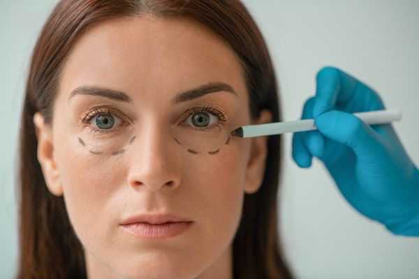 Tratamientos estéticos sin cirugía – Cirujano plástico realizando un boceto en el rostro de una mujer para aplicar un tratamiento de relleno de ojeras