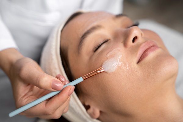 Tratamientos estéticos sin cirugía – Esteticista aplicando un tratamiento de peeling químico para rejuvenecer la piel de rostro