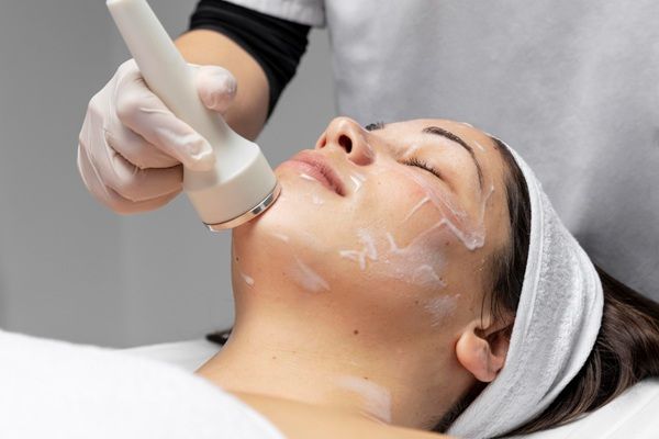 Exion - Mujer recibiendo un tratamiento de Exion facial para rejuvenecer la piel del rostro mediante la estimulación de la producción de colágeno