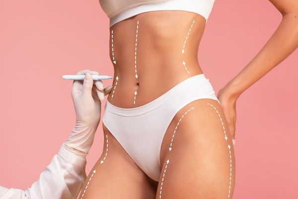 Remodelación corporal - Cirujano estético realizando el boceto del tratamiento remodelación corporal sin cirugía para eliminar la grasa y moldear acuerpo de una mujer