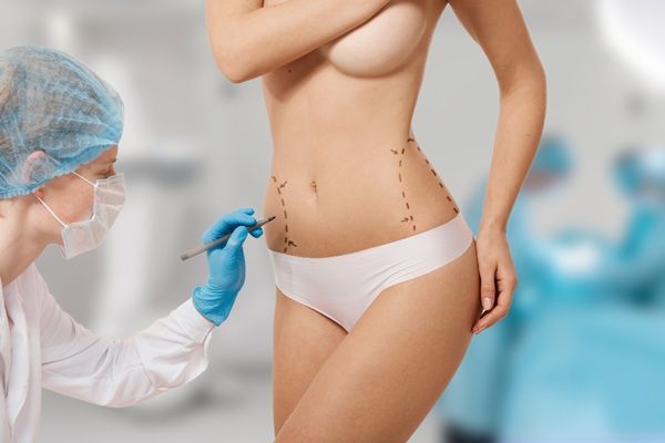 Mesoterapia corporal - Médico estético realizando el boceto del tratamiento estético con mesoterapia inyectada en una mujer para reducir grasa localizada