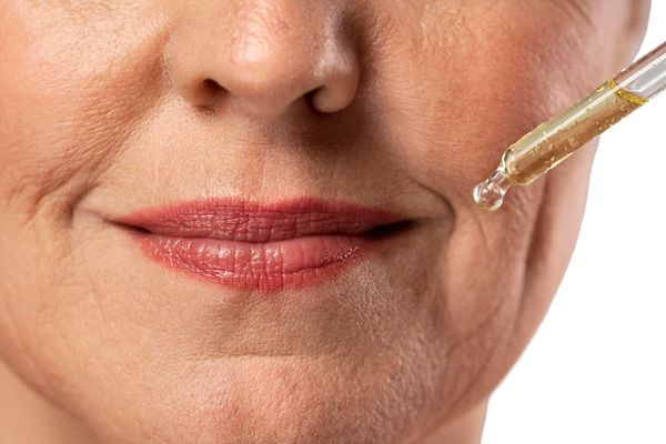 Relleno ácido hialurónico - Mujer aplicando una sustancia hidratante de ácido hialurónico Madrid para el tratamiento de ácido hialurónico labios