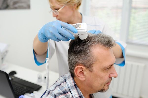 Soluciones a la calvicie - Tricóloga evaluando el cuero cabelludo de un hombre con alopecia para determinar la mejor técnica de implante capilar Madrid