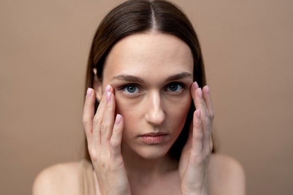 Ojeras - Mujer con arrugas en el entrecejo y ojeras causadas por el envejecimiento que se pueden tratar con bótox Madrid en la mejor clínica estética Madrid
