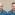 Implante capilar antes y después - Imagen comparativa de un hombre con alopecia luego del trasplante capilar Madrid en la mejor clínica injerto capilar Madrid