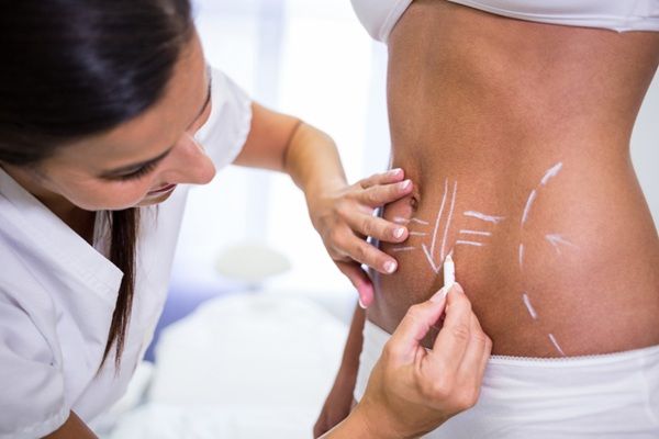 Tendencias en tratamientos estéticos - Médico estético realizando el boceto del tratamiento estético corporal sin cirugía a una mujer en una de las mejores clínicas estéticas Barcelona