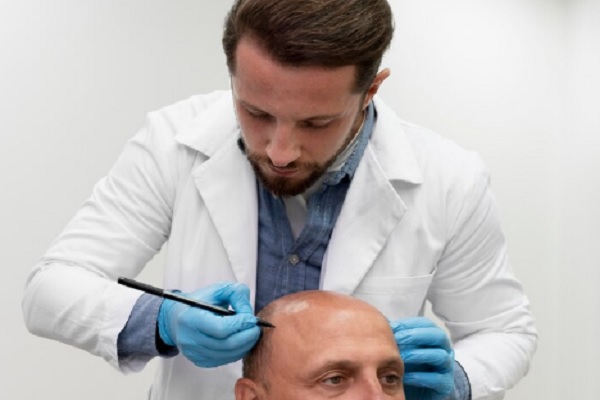 Novedades en injerto capilar Madrid - Diseó de línea frontal para injerto capilar Madrid