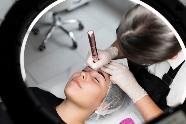 aplicación de rejuvenecimiento facial láser