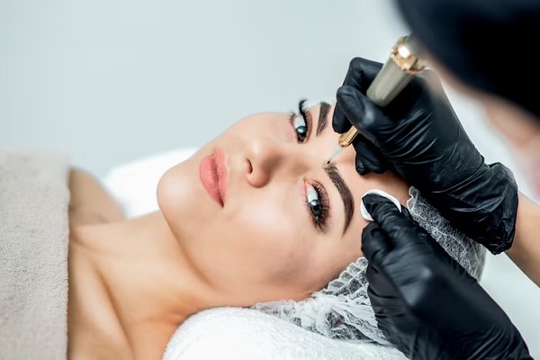 Láser facial