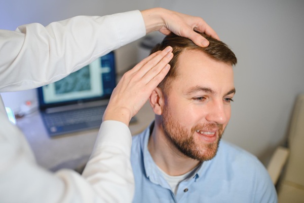Cuánto cuesta un implante capilar - Médico tricólogo evaluando el cuero cabelludo de un hombre con alopecia en la mejor clínica injerto capilar Madrid