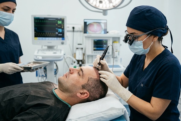 Médico tricólogo realizando un implante de cabello con la técnica DHI